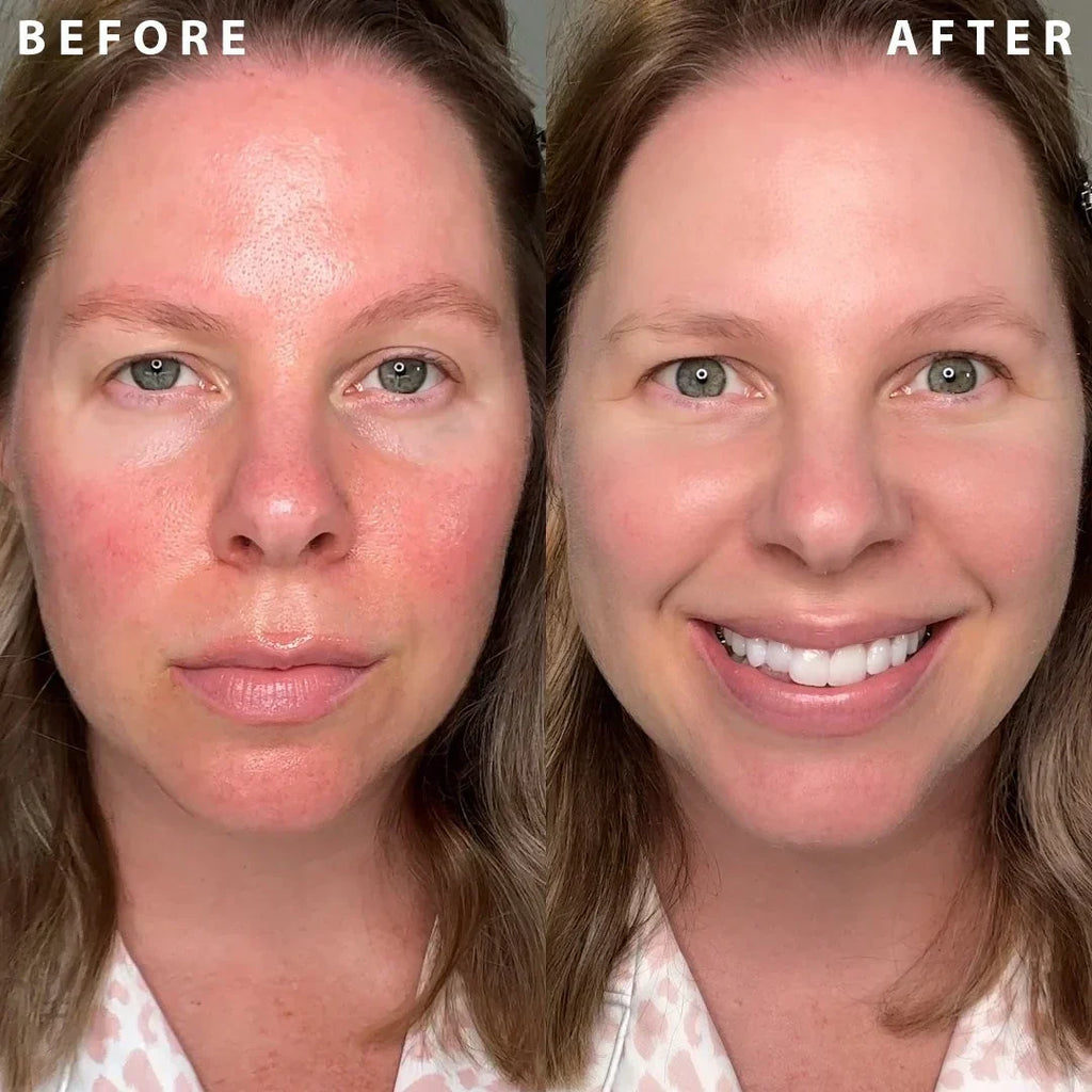 Il Makiage Power Camo Redness Defense - Age & Redness Control Soothing Primer: Green Tinted Makeup Primer that evens out skin tone and preps for makeup, enhancing your natural beauty.