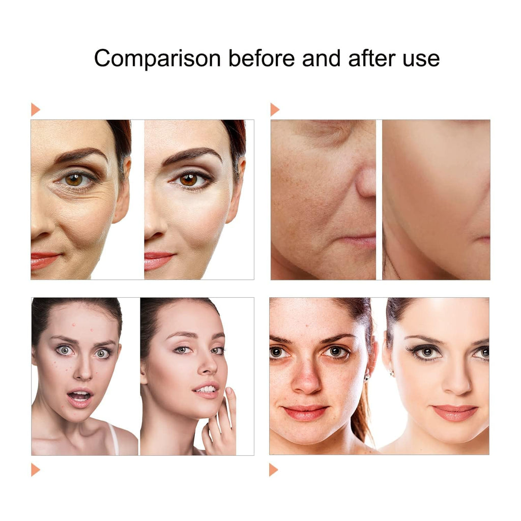 RED LIGHT THERAPY MASK