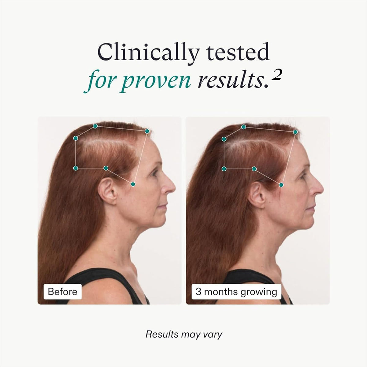 Women Nutrafol 1 month supply Hair Growth Balance health