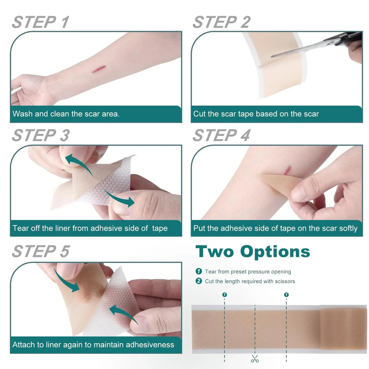 Silicone Scar Sheets (1.6"x 79" Roll-2M), Silicone Scar Tape for Scar Removal Treatment