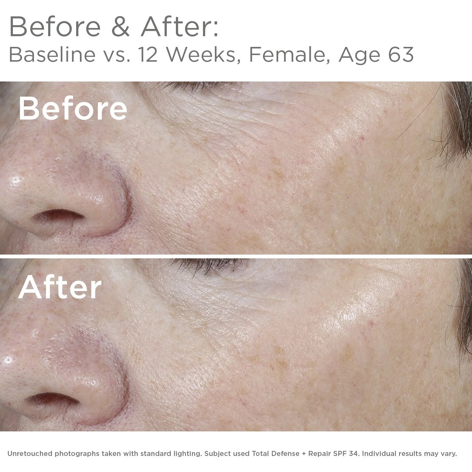 SkinMedica Total Defense + Repair SPF 34 Sunscreen for Face.